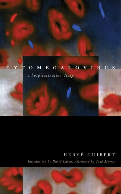 Cytomegalovirus - A Hospitalization Diary