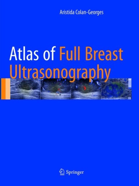 Atlas of Full Breast Ultrasonography