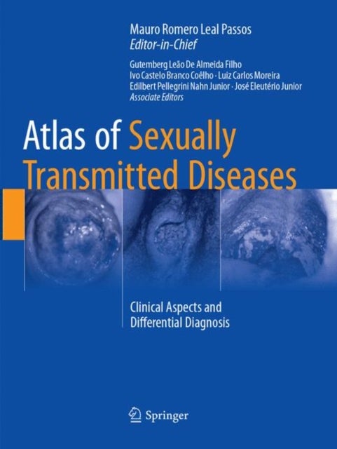 Atlas of Sexually Transmitted Diseases - Clinical Aspects and Differential Diagnosis