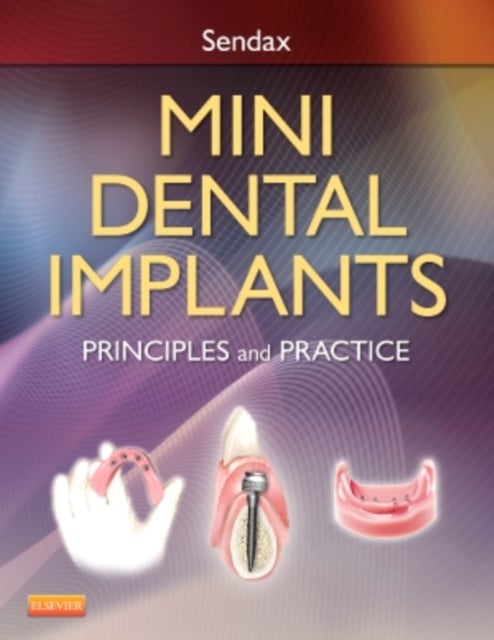 Mini Dental Implants - Principles and Practice