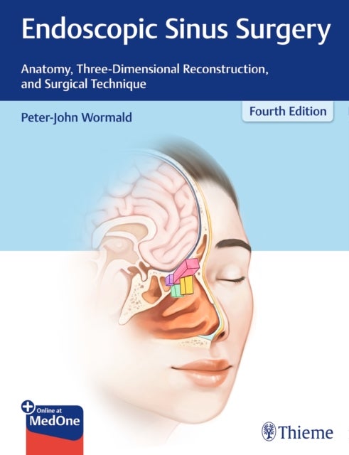 Endoscopic Sinus Surgery - Anatomy, Three-Dimensional Reconstruction, and Surgical Technique