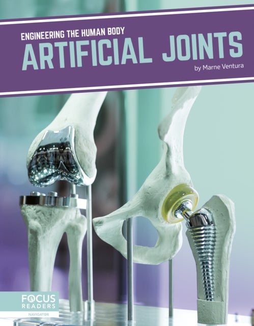 Artificial Joints av Marne Ventura