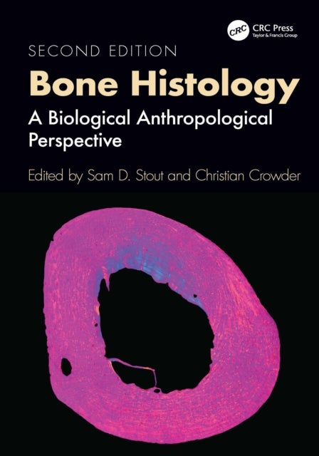 Bone Histology - A Biological Anthropological Perspective