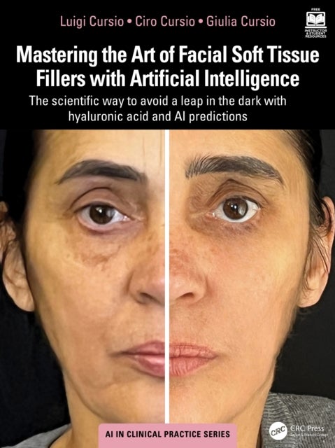 Mastering the Art of Facial Soft Tissue Fillers with Artificial Intelligence