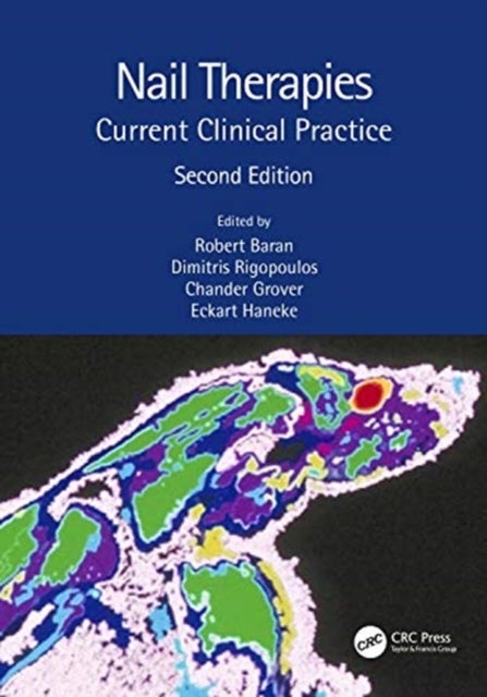 Nail Therapies - Current Clinical Practice