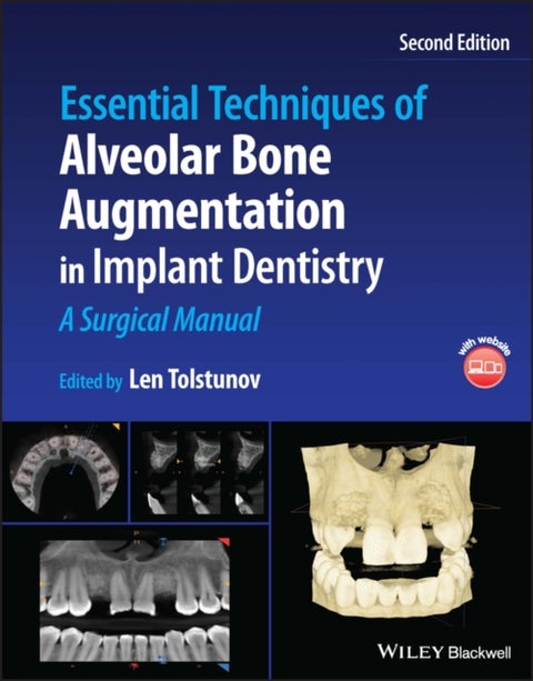 Essential Techniques of Alveolar Bone Augmentation in Implant Dentistry - A Surgical Manual