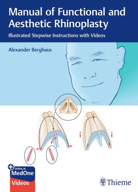 Manual of Functional and Aesthetic Rhinoplasty - Illustrated Stepwise Instructions with Videos