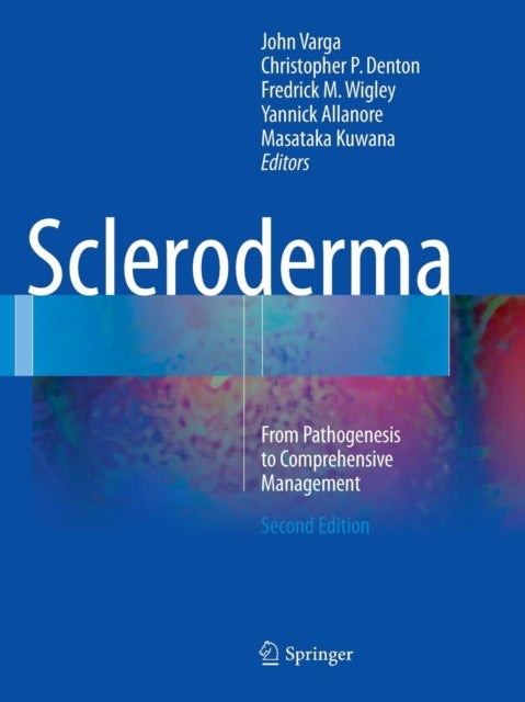 Scleroderma - From Pathogenesis to Comprehensive Management