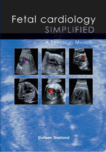 Fetal Cardiology Simplified - A Practical Manual