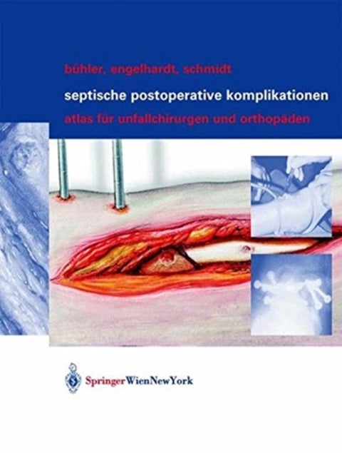 Septische postoperative Komplikationen - Atlas fur Unfallchirurgen und Orthopaden