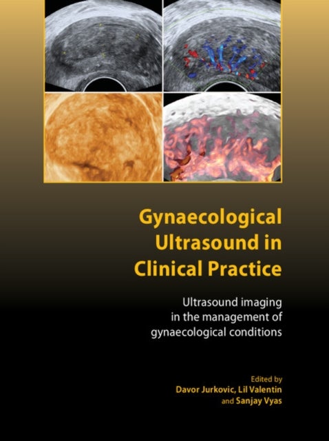 Gynaecological Ultrasound in Clinical Practice - Ultrasound Imaging in the Management of Gynaecological Conditions