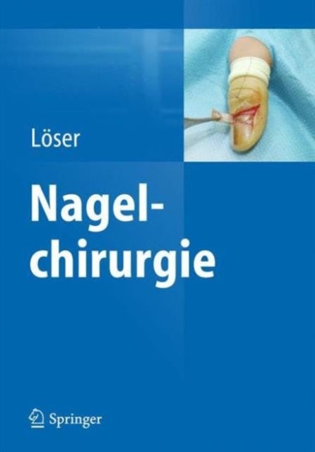 Nagelchirurgie