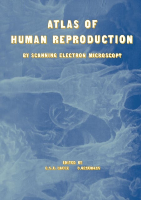 Atlas of Human Reproduction - By Scanning Electron Microscopy