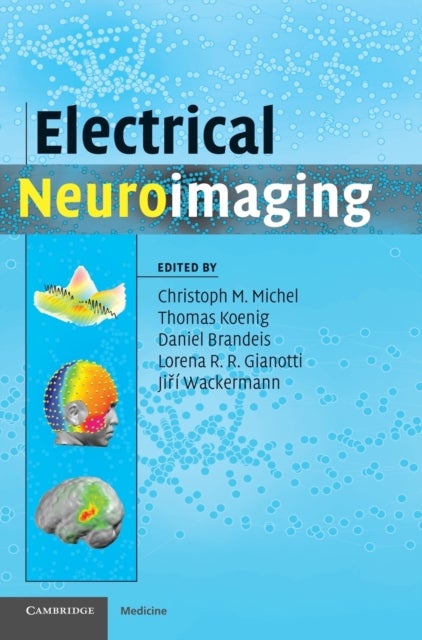 Electrical Neuroimaging