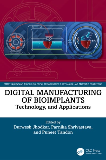 Digital Manufacturing of Bioimplants - Technology and Applications