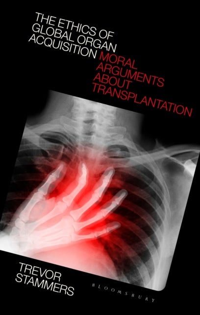 The Ethics of Global Organ Acquisition - Moral Arguments about Transplantation