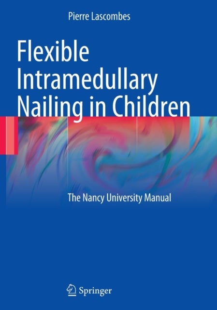 Flexible Intramedullary Nailing in Children - The Nancy University Manual
