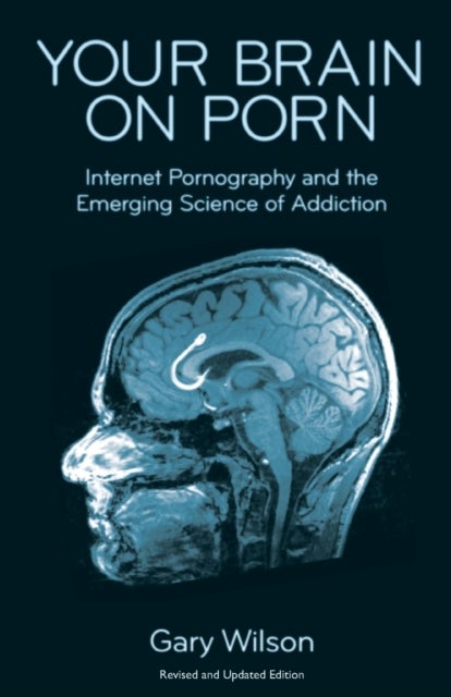 Your Brain on Porn - Internet Pornography and the Emerging Science of Addiction
