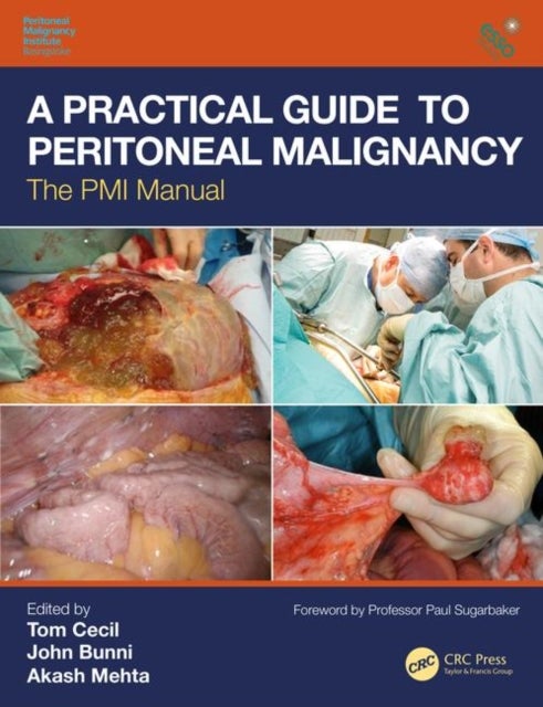 A Practical Guide to Peritoneal Malignancy - The PMI Manual