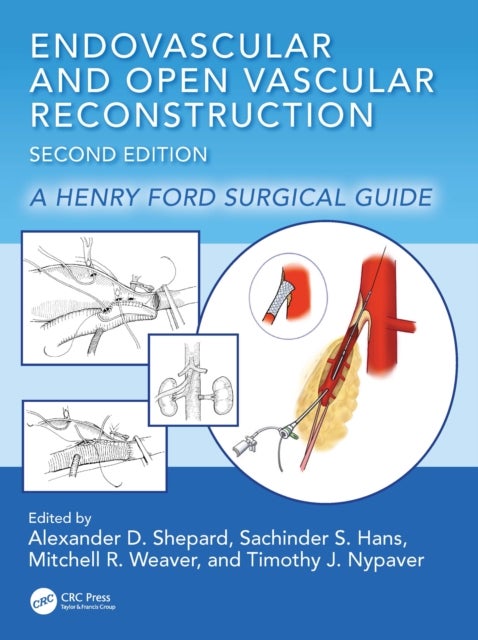 Endovascular and Open Vascular Reconstruction - A Henry Ford Surgical Guide