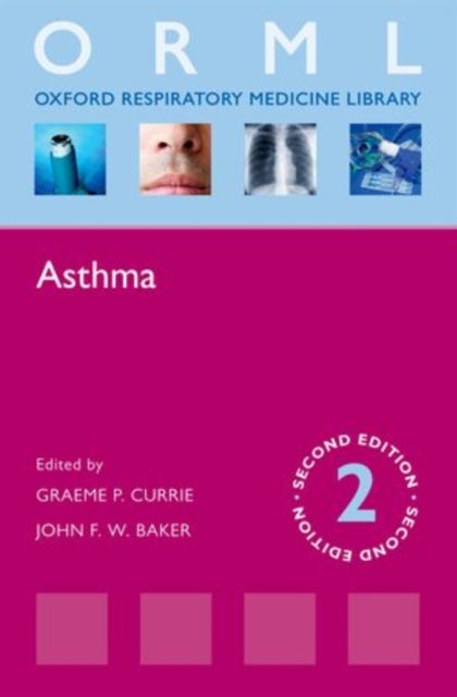 Asthma