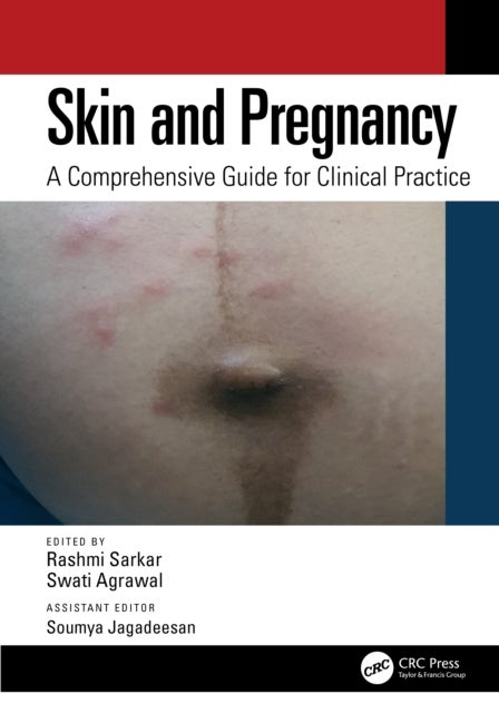 Skin and Pregnancy - A Comprehensive Guide for Clinical Practice