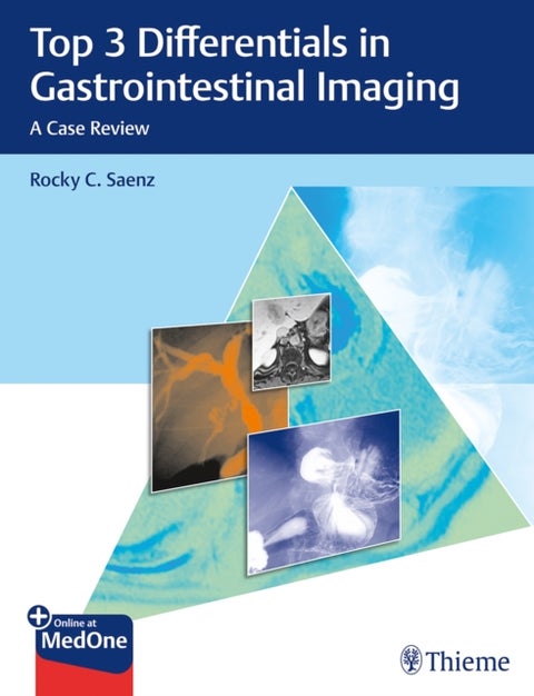 Top 3 Differentials in Gastrointestinal Imaging - A Case Review