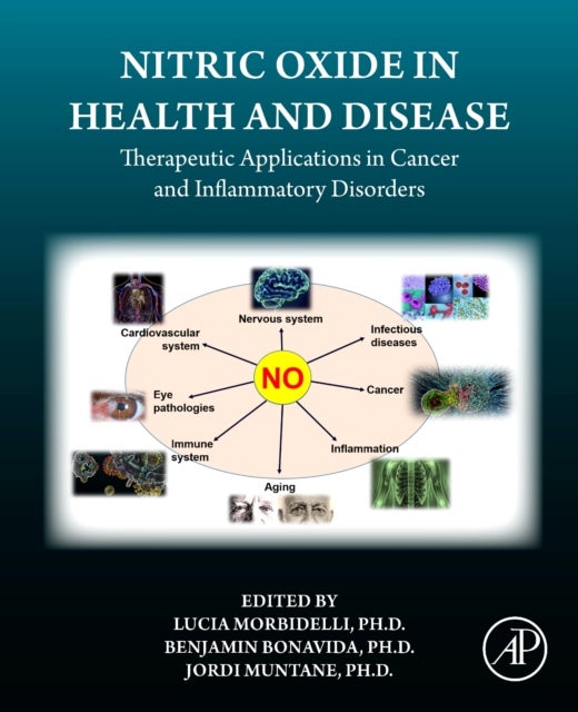 Nitric Oxide in Health and Disease - Therapeutic Applications in Cancer and Inflammatory Disorders