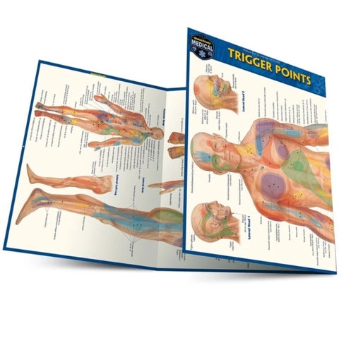Trigger points