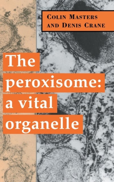 The Peroxisome - A Vital Organelle