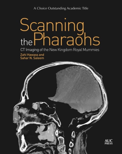 Scanning the Pharaohs - CT Imaging of the New Kingdom Royal Mummies