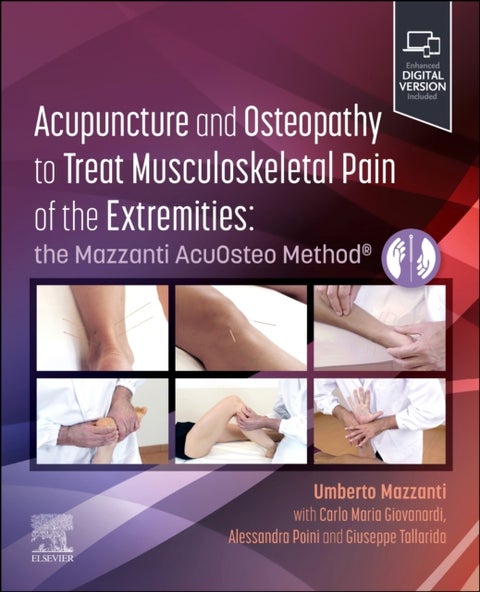 Acupuncture and Osteopathy to Treat Musculoskeletal Pain of the Extremities - the Mazzanti AcuOsteo Method®