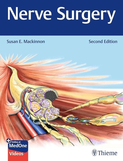Nerve Surgery