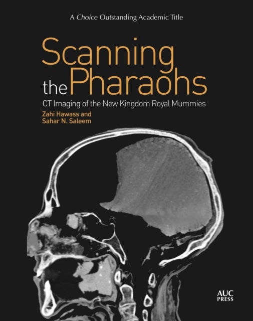 Scanning the Pharaohs - CT Imaging of the New Kingdom Royal Mummies