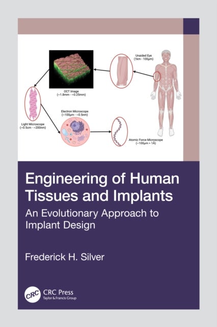 Engineering of Human Tissues and Implants - An Evolutionary Approach to Implant Design