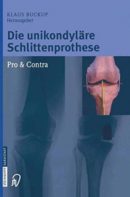 Die unikondylare Schlittenprothese Pro & Contra