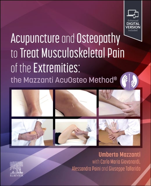 Acupuncture and Osteopathy to Treat Musculoskeletal Pain of the Extremities - the Mazzanti AcuOsteo Method®