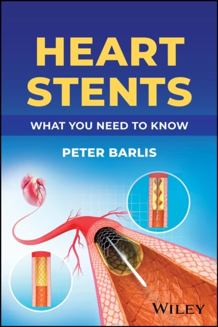 Understanding Heart Stents - What You Need to Know