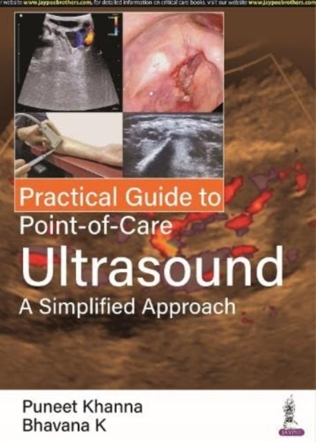 Practical Guide to Point-of-Care Ultrasound - A Simplified Approach