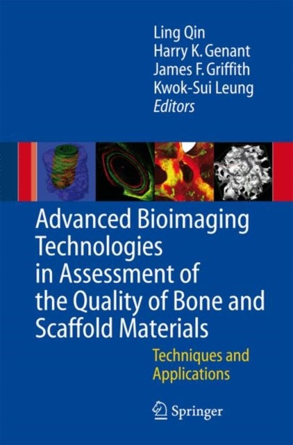 Advanced Bioimaging Technologies in Assessment of the Quality of Bone and Scaffold Materials - Techniques and Applications
