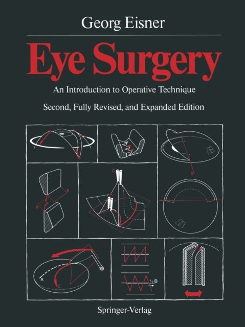 Eye Surgery - An Introduction to Operative Technique