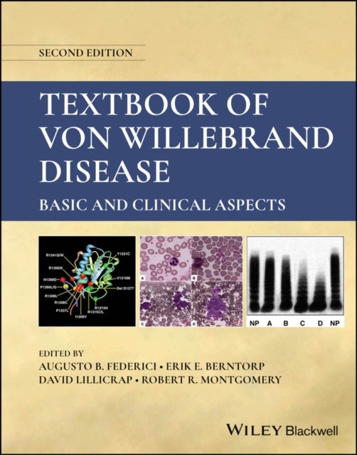 Textbook of Von Willebrand Disease - Basic and Clinical Aspects