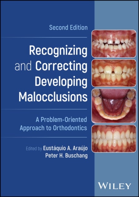 Recognizing and Correcting Developing Malocclusions - A Problem-Oriented Approach to Orthodontics
