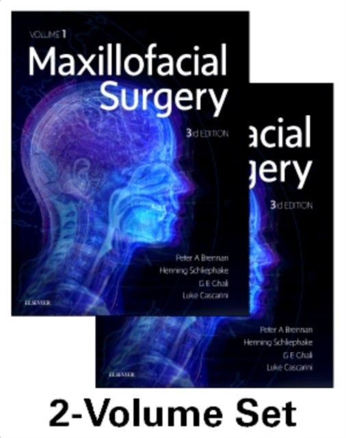 Maxillofacial Surgery - 2-Volume Set