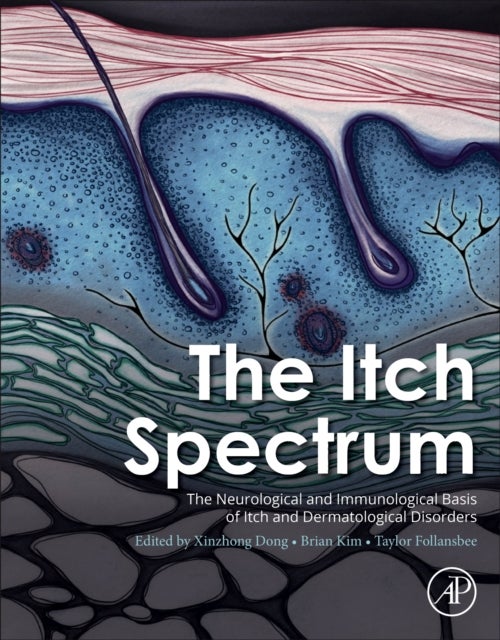 The Itch Spectrum