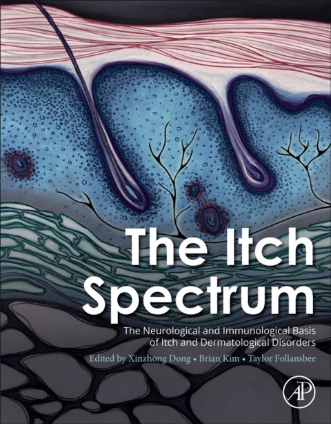 The Itch Spectrum