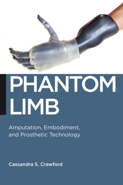 Phantom Limb - Amputation, Embodiment, and Prosthetic Technology