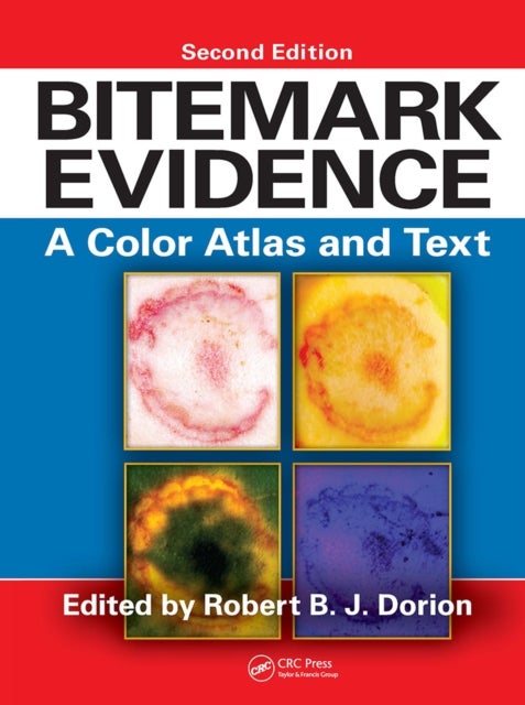 Bitemark Evidence - A Color Atlas and Text, 2nd Edition