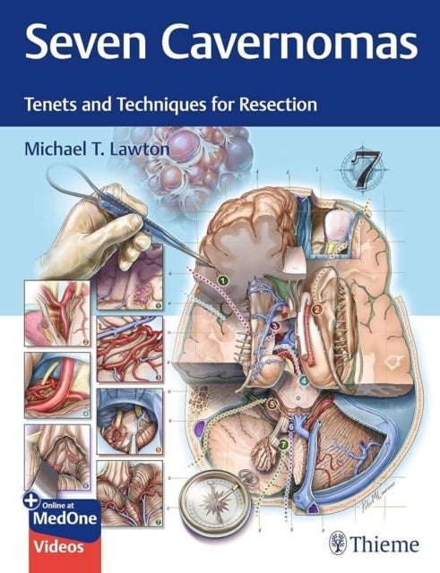 Seven Cavernomas - Tenets and Techniques for Resection