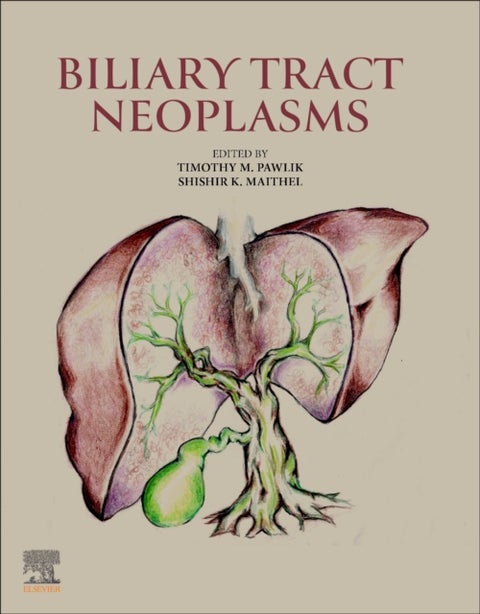 Biliary Tract Neoplasms
